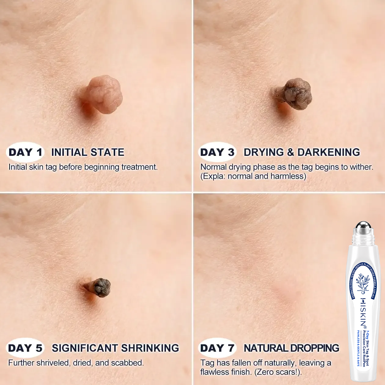 ✒️HiSkin® Advanced Firming Peptide Skin Cream