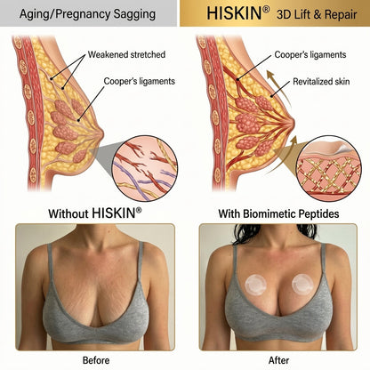 🎁𝐇𝐈𝐒𝐊𝐈𝐍® 👩‍⚕️ Targeted Breast Enhancement Advanced Nano Microneedle Patch